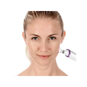 Аппарат для микродермамбразии Beurer FC 76